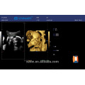 3D 4D USG Full digital 4D Ultrasound Price Trolley 4D Ultrasound Machine